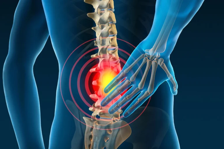 When Back Pain Is Not a Muscle Problem